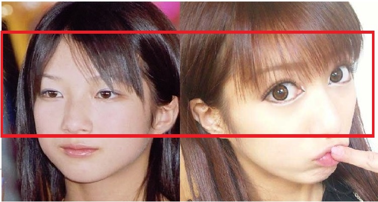 目頭切開＿辻希美