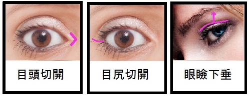 美容整形_目_011