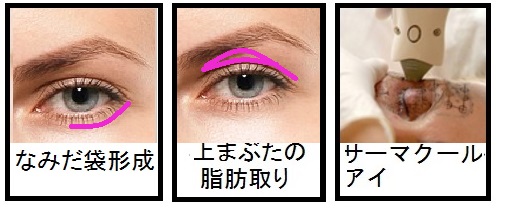 美容整形_目_015